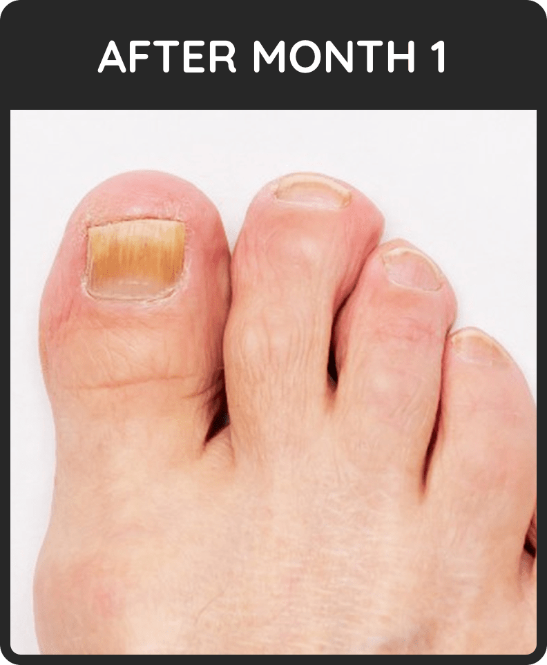 Kerassentials Users. Real Life-Changing Results.