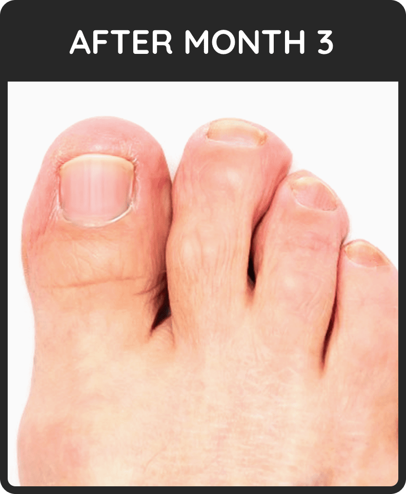 Kerassentials Users. Real